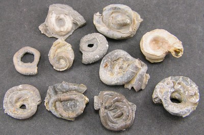 Glomerula gordialis