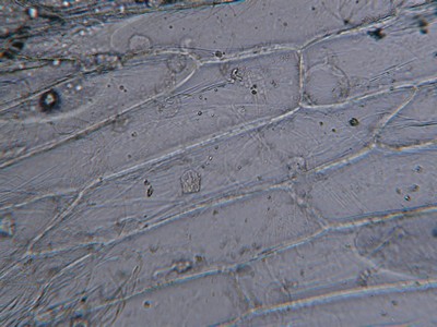 Cellules d'oignon rouge