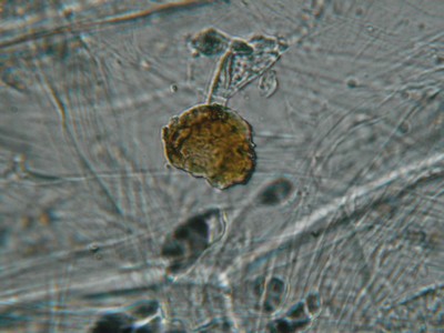 Cellules d'oignon rouge