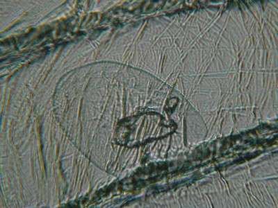 Cellules d'oignon rouge