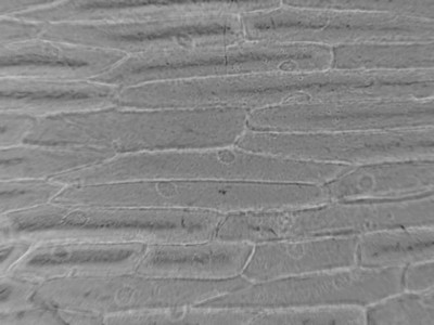 Cellules d'oignon blanc