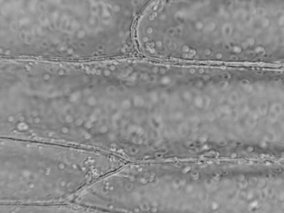 Cellules d'oignon blanc