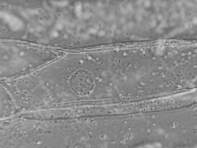 Cellules d'oignon blanc